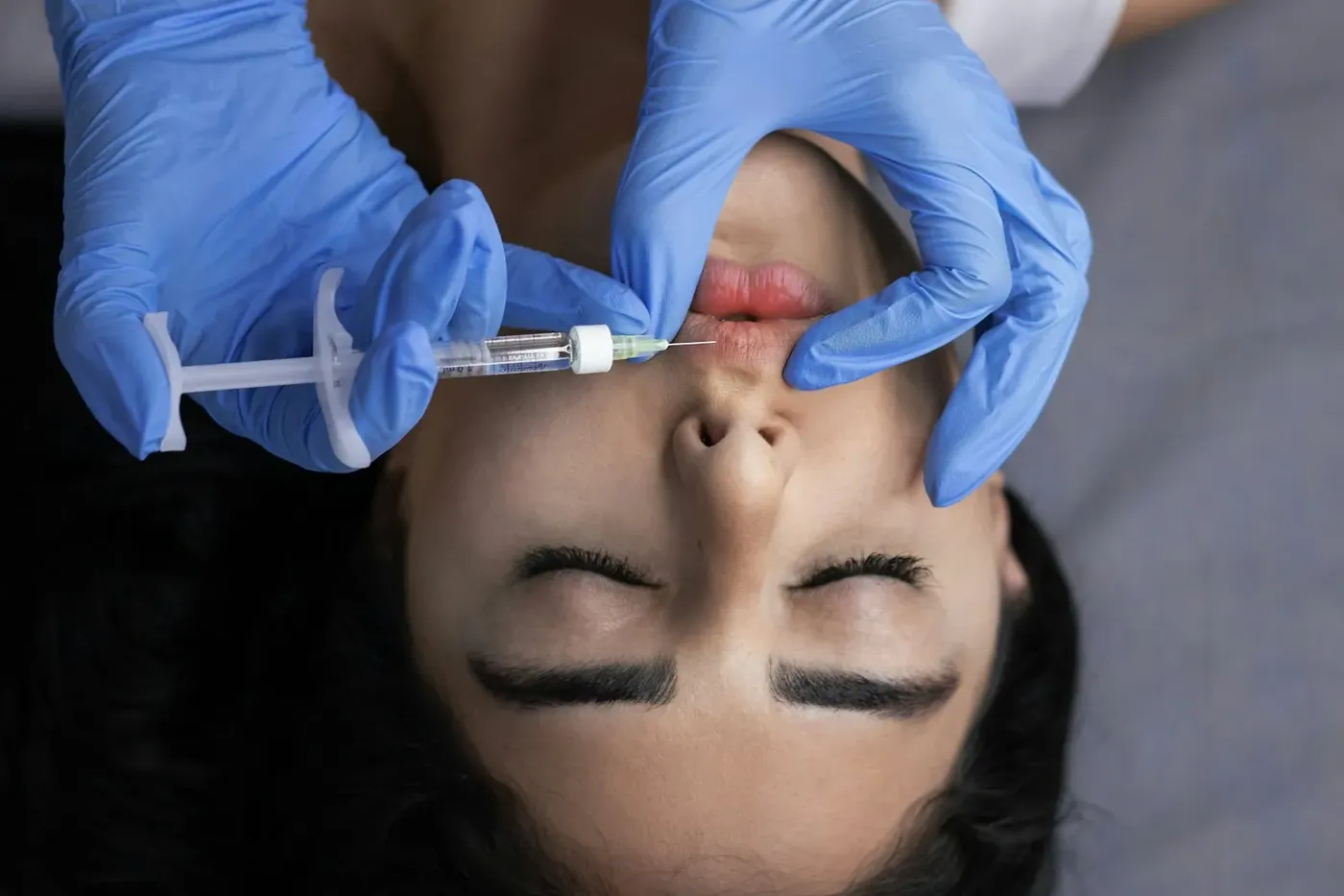 Nahaufnahme einer Lippenbehandlung mit feiner Nadel