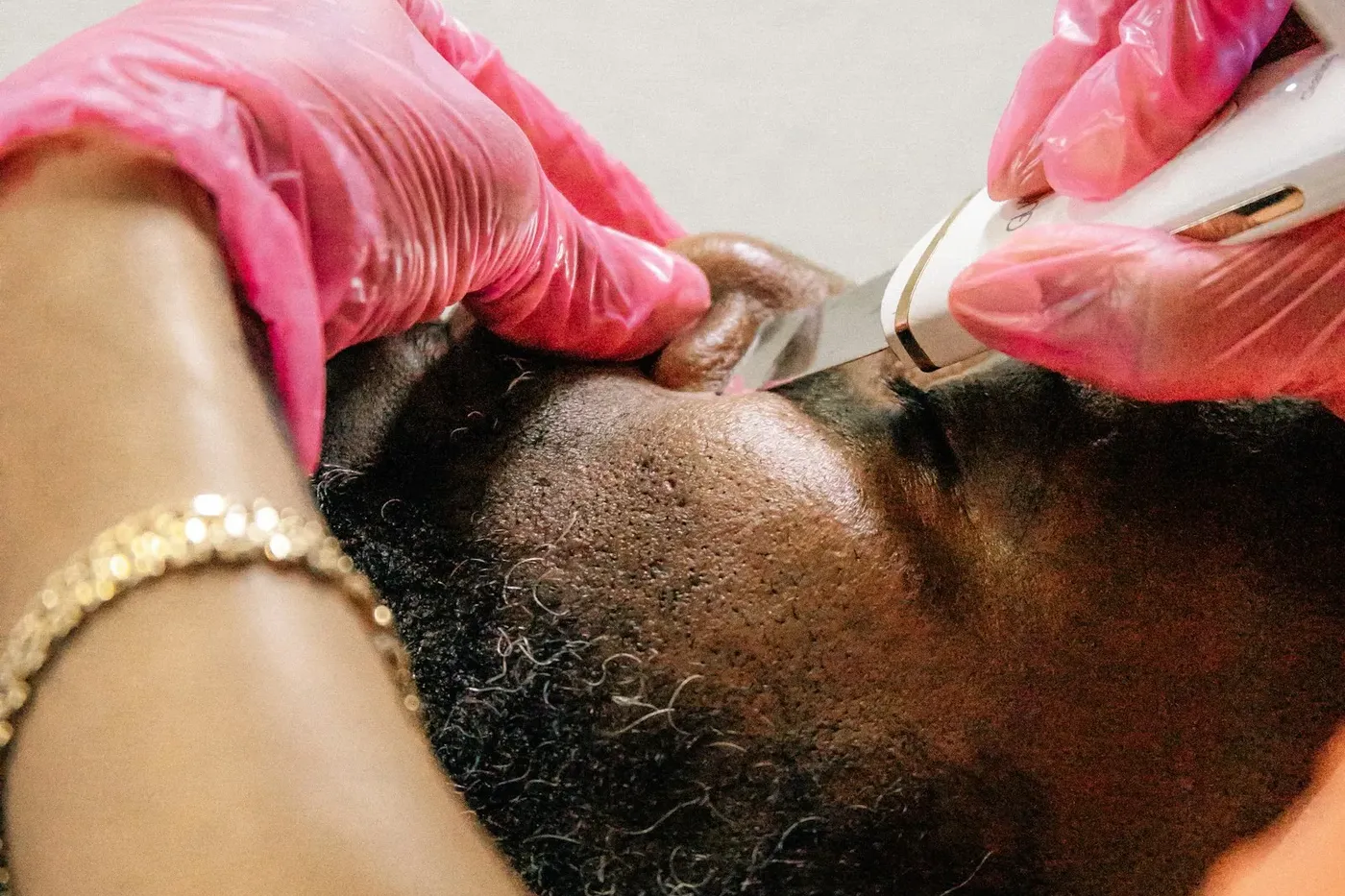 Cosmetic treatment on the side of the face, gloved hands visible